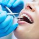 Имплантация зубов в Минске