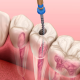 Чистка Air Flow в стоматологии «Новый Век»: отзывы до и после процедуры